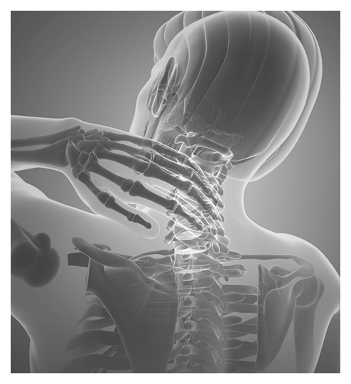 Neck Surgery Des Moines, Stiff Neck - Nebraska Spine Hospital